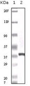 S100 Calcium Binding Protein A6 antibody, abx015725, Abbexa, Enzyme Linked Immunosorbent Assay image 