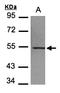 Putative tubulin beta-4q chain antibody, orb73624, Biorbyt, Western Blot image 