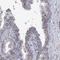 NADH:Ubiquinone Oxidoreductase Subunit C2 antibody, HPA038873, Atlas Antibodies, Immunohistochemistry paraffin image 