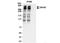 Zinc Finger Protein 407 antibody, NBP2-34852, Novus Biologicals, Immunoprecipitation image 