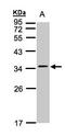 Calcium Voltage-Gated Channel Auxiliary Subunit Gamma 5 antibody, LS-B4222, Lifespan Biosciences, Western Blot image 