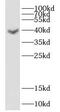 Deoxyhypusine synthase antibody, FNab02368, FineTest, Western Blot image 