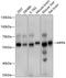 Membrane Palmitoylated Protein 6 antibody, A11613, Boster Biological Technology, Western Blot image 