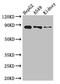 Carnitine Palmitoyltransferase 1A antibody, LS-C677588, Lifespan Biosciences, Western Blot image 
