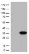 Nicotinamide Riboside Kinase 2 antibody, CF813057, Origene, Western Blot image 