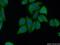 Phosphate Cytidylyltransferase 2, Ethanolamine antibody, 14827-1-AP, Proteintech Group, Immunofluorescence image 