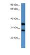 Serine/threonine/tyrosine-interacting-like protein 1 antibody, NBP1-79814, Novus Biologicals, Western Blot image 