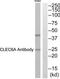 C-Type Lectin Domain Containing 6A antibody, TA315998, Origene, Western Blot image 