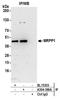 TRNA Methyltransferase 10C, Mitochondrial RNase P Subunit antibody, A304-390A, Bethyl Labs, Immunoprecipitation image 