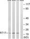 Mitochondrial Ribosomal Protein S17 antibody, A14408, Boster Biological Technology, Western Blot image 