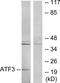 Cyclic AMP-dependent transcription factor ATF-3 antibody, TA313482, Origene, Western Blot image 
