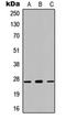 WAP, Follistatin/Kazal, Immunoglobulin, Kunitz And Netrin Domain Containing 1 antibody, orb234858, Biorbyt, Western Blot image 