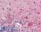 ATF4 antibody, LS-B3517, Lifespan Biosciences, Immunohistochemistry paraffin image 