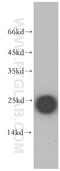 Chorionic Somatomammotropin Hormone Like 1 antibody, 11883-1-AP, Proteintech Group, Western Blot image 