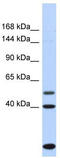 Pleckstrin And Sec7 Domain Containing 3 antibody, TA344113, Origene, Western Blot image 