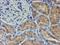 Leukocyte Cell Derived Chemotaxin 2 antibody, NBP2-01632, Novus Biologicals, Immunohistochemistry paraffin image 