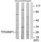 Tumor Protein P53 Inducible Nuclear Protein 1 antibody, TA313400, Origene, Western Blot image 