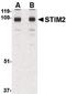 Stromal interaction molecule 2 antibody, PA5-20372, Invitrogen Antibodies, Western Blot image 
