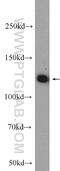 Chromosome 20 Open Reading Frame 194 antibody, 23184-1-AP, Proteintech Group, Western Blot image 
