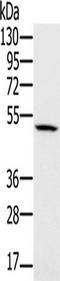 Proteasome 26S Subunit, ATPase 2 antibody, TA350186, Origene, Western Blot image 