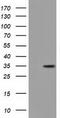 Geranylgeranyl Diphosphate Synthase 1 antibody, CF501730, Origene, Western Blot image 