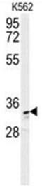 Aldo-Keto Reductase Family 1 Member C3 antibody, AP50133PU-N, Origene, Western Blot image 
