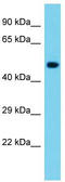 Notchless Homolog 1 antibody, TA337898, Origene, Western Blot image 