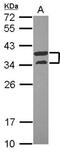 ATPase H+ Transporting V1 Subunit D antibody, NBP2-15518, Novus Biologicals, Western Blot image 