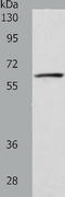 VANGL Planar Cell Polarity Protein 1 antibody, TA324042, Origene, Western Blot image 