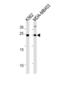 Sarcospan antibody, abx034867, Abbexa, Western Blot image 