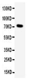 Proprotein Convertase Subtilisin/Kexin Type 2 antibody, PA2085, Boster Biological Technology, Western Blot image 