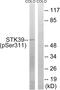 Serine/Threonine Kinase 39 antibody, AP55774PU-N, Origene, Western Blot image 