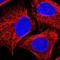 ACS antibody, NBP1-92088, Novus Biologicals, Immunocytochemistry image 
