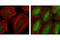p65 antibody, 3033P, Cell Signaling Technology, Immunofluorescence image 