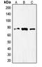 Forkhead Box O1 antibody, orb213938, Biorbyt, Western Blot image 