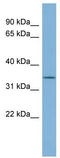 Growth Hormone Releasing Hormone Receptor antibody, TA346230, Origene, Western Blot image 