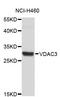 Voltage Dependent Anion Channel 3 antibody, STJ26082, St John