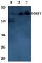 DEAD-Box Helicase 3 Y-Linked antibody, A06062, Boster Biological Technology, Western Blot image 