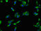 Acylaminoacyl-Peptide Hydrolase antibody, orb21259, Biorbyt, Immunocytochemistry image 