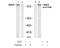 Receptor tyrosine-protein kinase erbB-3 antibody, AP08032PU-N, Origene, Western Blot image 