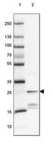 Protein Phosphatase 1 Regulatory Inhibitor Subunit 1A antibody, PA5-59618, Invitrogen Antibodies, Western Blot image 