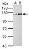 Zinc Finger Protein 711 antibody, PA5-31652, Invitrogen Antibodies, Western Blot image 