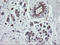 Ubiquitin Conjugating Enzyme E2 J1 antibody, LS-C174104, Lifespan Biosciences, Immunohistochemistry frozen image 