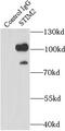 Stromal interaction molecule 2 antibody, FNab08322, FineTest, Immunoprecipitation image 