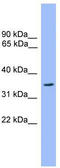 Olfactory Receptor Family 2 Subfamily C Member 3 antibody, TA342707, Origene, Western Blot image 