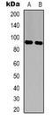 Lon Peptidase 2, Peroxisomal antibody, LS-C368715, Lifespan Biosciences, Western Blot image 