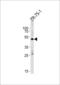 Angiotensin II type-1 receptor antibody, LS-C203904, Lifespan Biosciences, Western Blot image 
