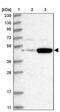 V-Set And Immunoglobulin Domain Containing 1 antibody, PA5-57605, Invitrogen Antibodies, Western Blot image 