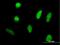 DEAD-Box Helicase 42 antibody, H00011325-B01P, Novus Biologicals, Immunocytochemistry image 