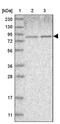 Nucleolar Protein 11 antibody, PA5-54549, Invitrogen Antibodies, Western Blot image 